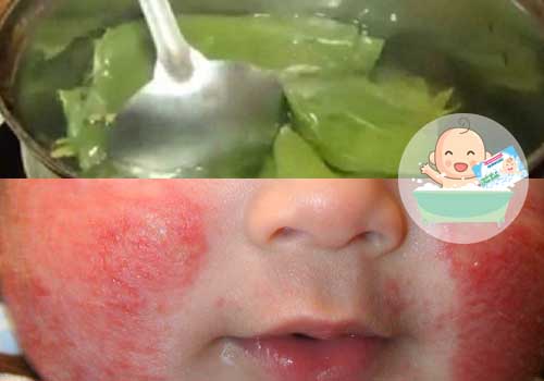 Đun nước lá trầu không tắm trị chàm sữa cho bé