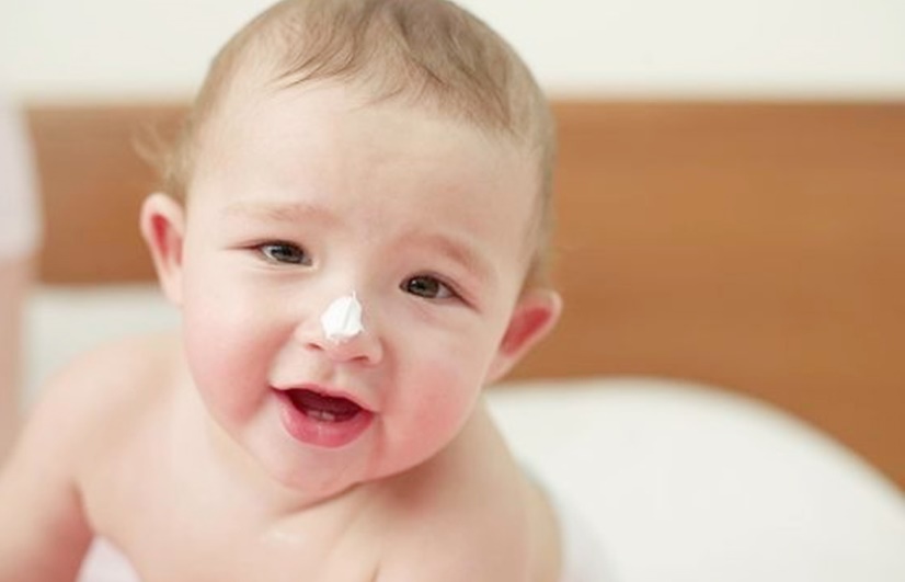 Bôi thuốc mỡ sẽ giúp trẻ dễ chịu hơn