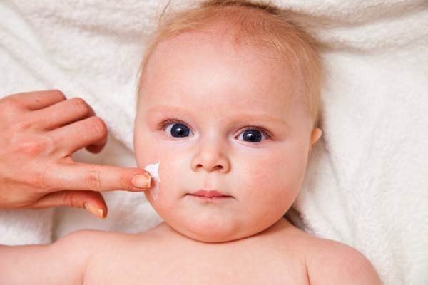 Chàm sữa gây khô da, vì vậy bé rất cần có kem dưỡng ẩm