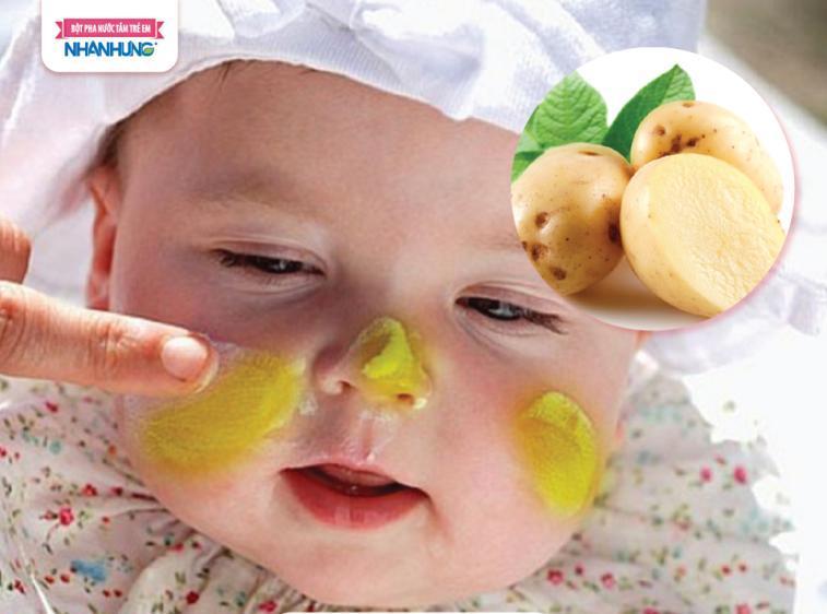 Khoai tây cũng là “khắc tinh” của chàm sữa