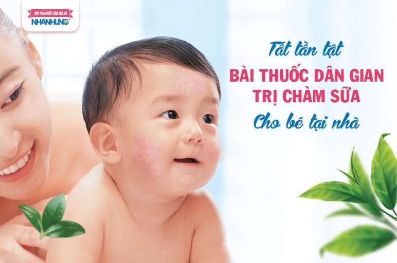 Mẹ có thể áp dụng bài thuốc dân gian để trị chàm sữa cho trẻ