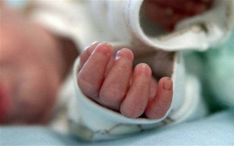 Trẻ có thể tử vong vì chàm sữa