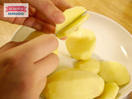 Khoai tây giúp trẻ bớt ngứa do muỗi đốt