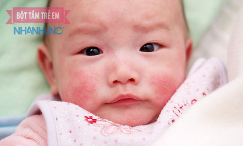 Biểu hiện bé sơ sinh bị nổi mẩn đỏ ở mặt có thể do nhiều bệnh lý về da khác nhau