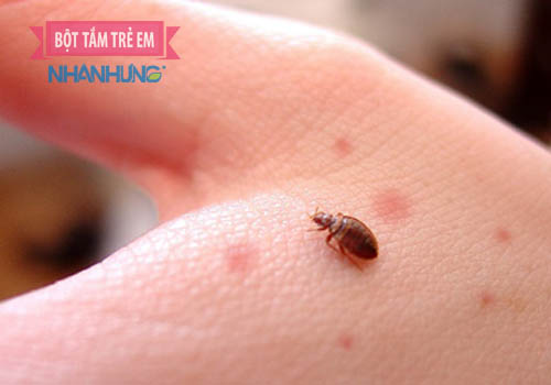 Côn trùng rất “thích” tấn công trẻ nhỏ
