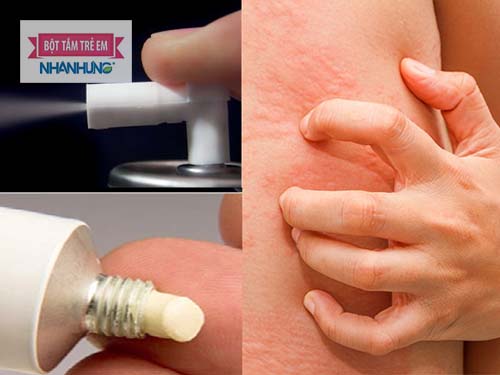 Thuốc trị ghẻ nước cho trẻ có 3 loại: thuốc uống, thuốc xịt và thuốc bôi - Trị ghẻ ngứa ở trẻ em