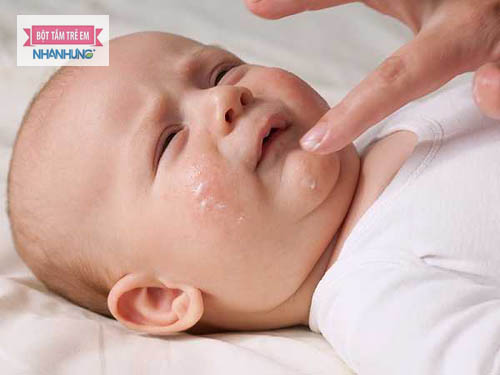 Nên xin ý kiến bác sĩ trước khi sử dụng thuốc trị viêm da dị ứng cho trẻ