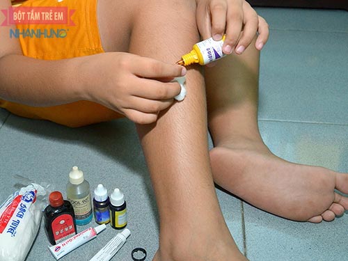 Cần vệ sinh vết trầy xước cho trẻ đúng cách